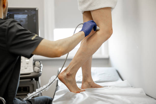 Best Varicose Veins Treatment in Bandra